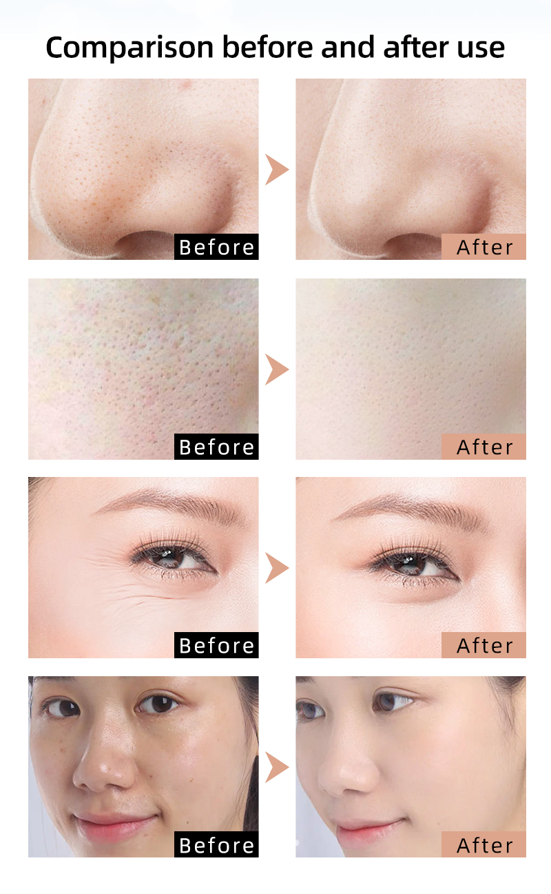 comparison before and after use_06